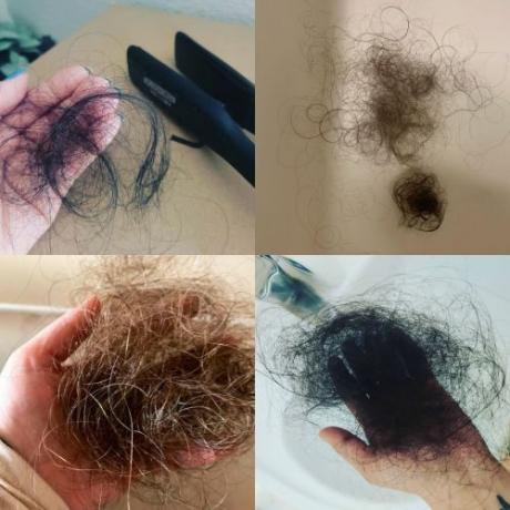 Ľudia, ktorí zdieľajú svoje vypadávanie vlasov COVID na Instagrame