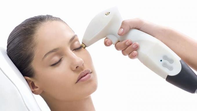 Tratamientos alternativos para la piel para el acné