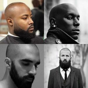 10 najboljših pričesk in odbitkov za moške z izpadanjem las